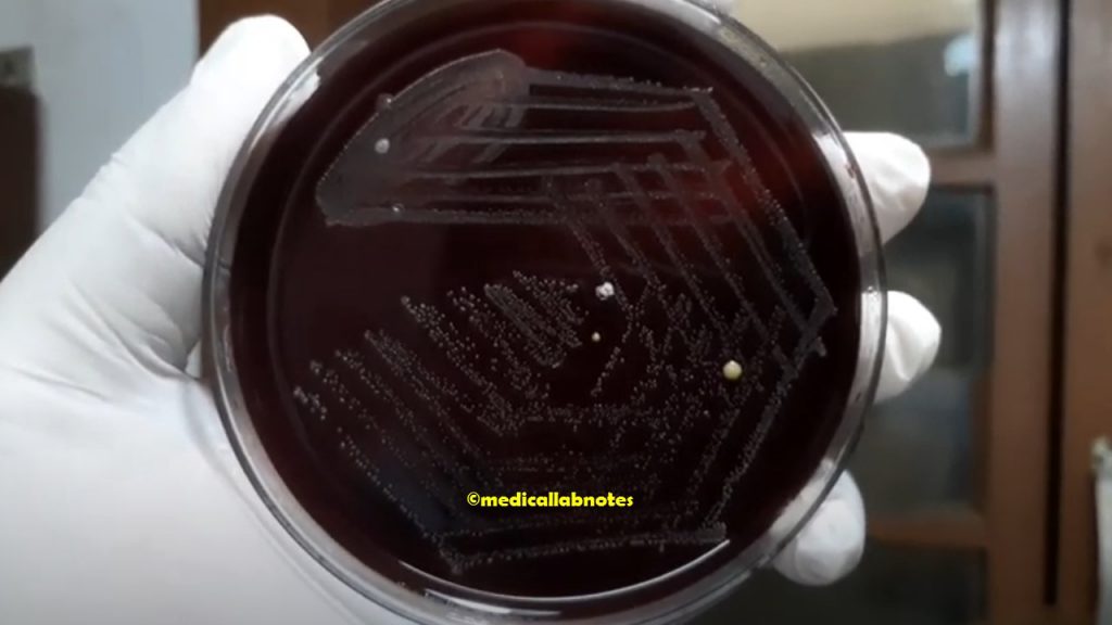 Streptococcus pyogenes colony morphology on blood agar