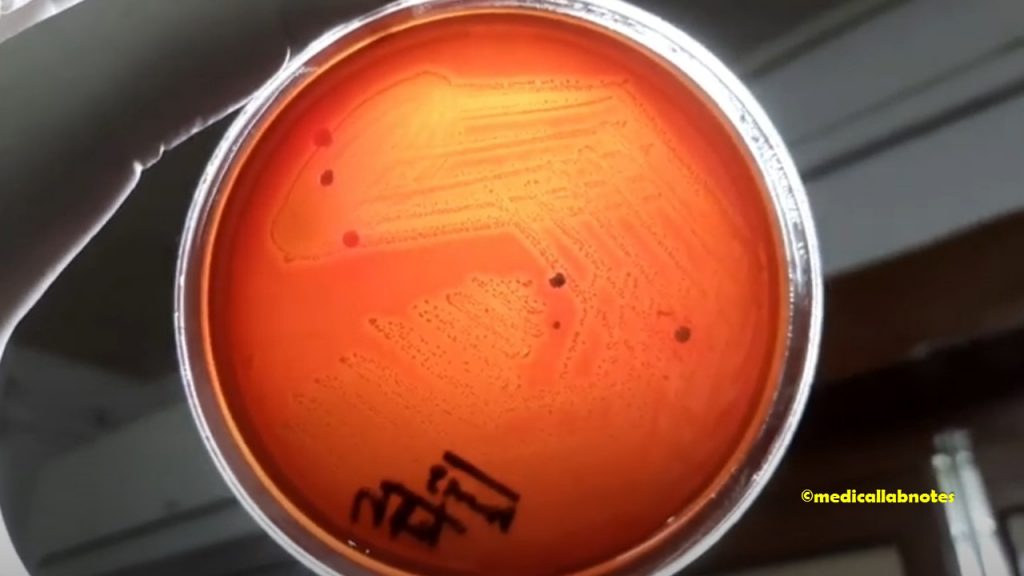 Streptococcus pyogenes colony morphology on blood agar showing beta-hemolytic colonies