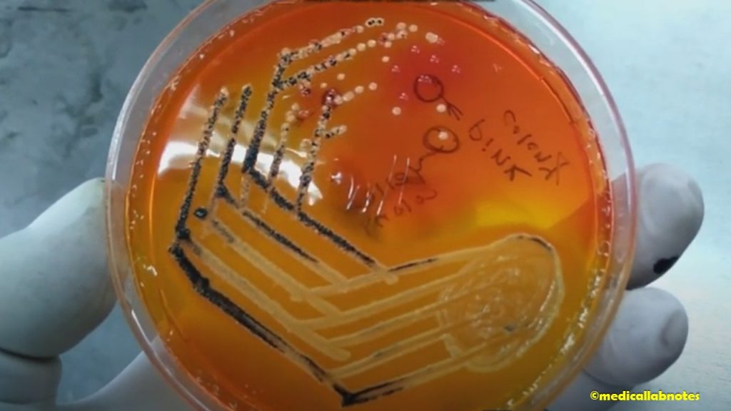 Suspected colony of Salmonella Typhi and Shigella on XLD agar of stool or feces culture