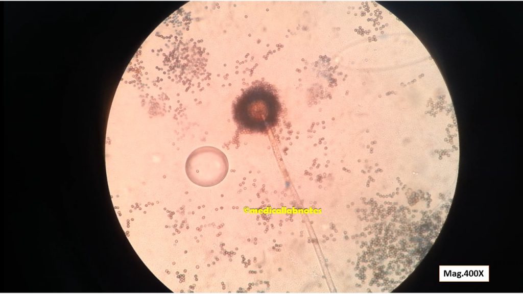 Syncephlastrum in LPCB tease mount showing sporangiophores, merosporangia and merospores 