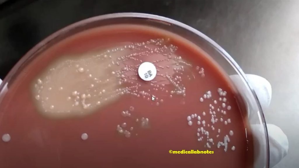 Use of Bacitracin (10 Units) disk in blood agar for screening Haemophilus species