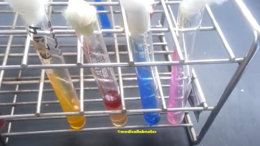 Vibrio cholerae Biochemical Tests
