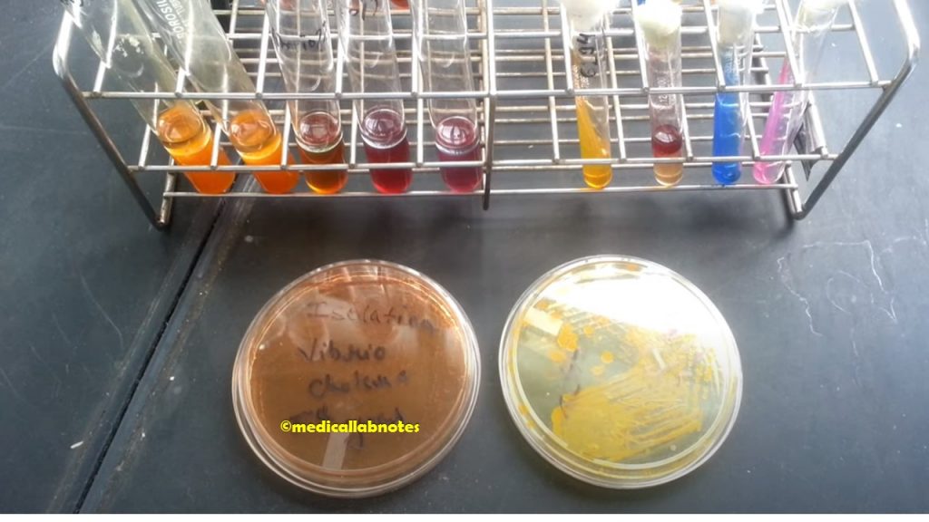 Vibrio cholerae growth on MacConkey medium, TCBS agar and various biochemical tests