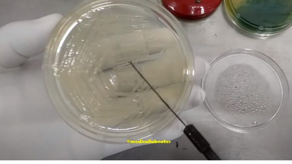 Vibrio cholerae growth on nutrient agar