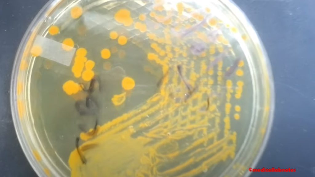 Vibrio cholerae yellow colony on TCBS agar