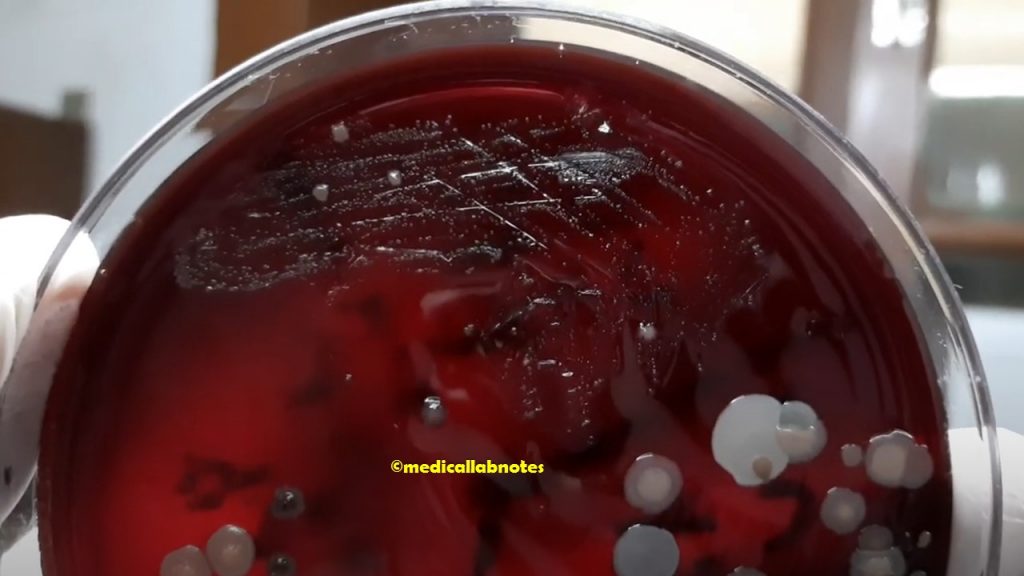 Viridans streptococci colony morphology on blood agar