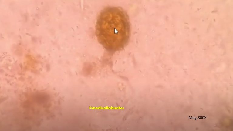 Saline Wet Mount Microscopy: Introduction, Principle, Test Requi