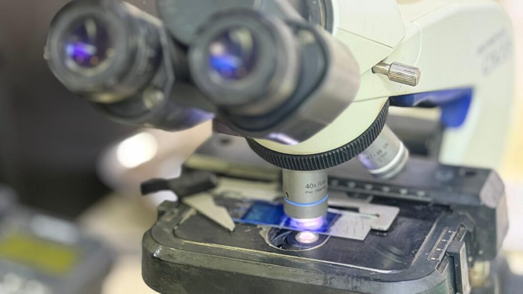 Microscope viewing a glass slide with Lactophenol Cotton Blue (LPCB)  tease mount of yeasts culture in a laboratory setting