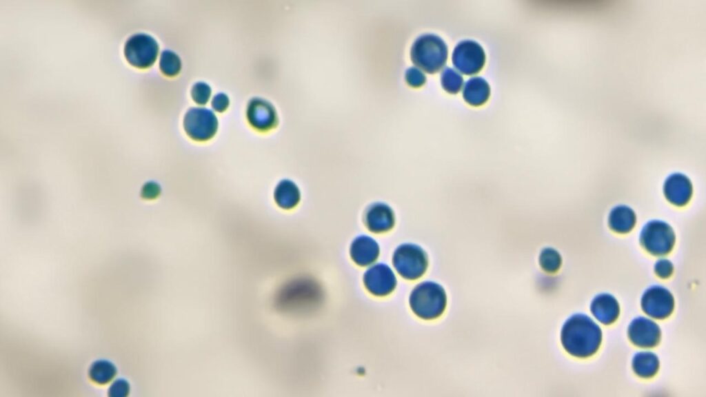 Microscopic view of yeast cells and budding yeast forms stained with Lactophenol Cotton Blue (LPCB) from a culture (small  colony of yeast) tease mount.