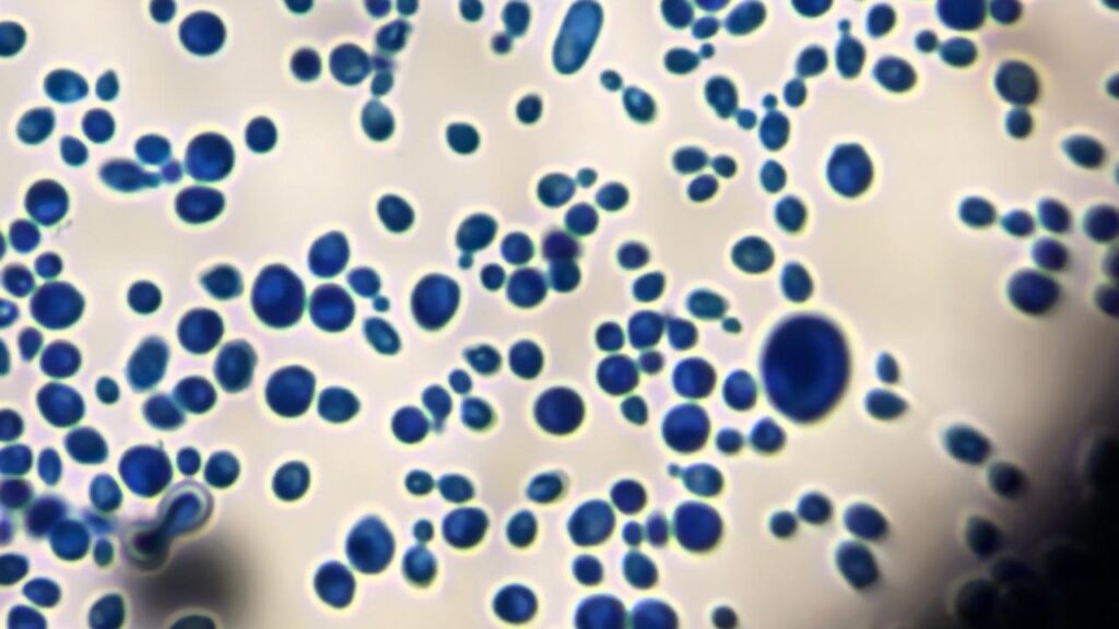 Microscopic view of yeast cells and budding yeast forms stained with Lactophenol Cotton Blue (LPCB) from a culture (small  colony of yeast) tease mount.