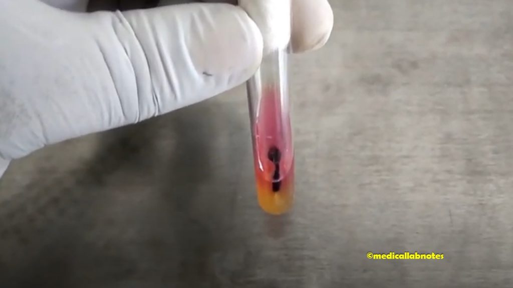 Salmonella Typhi Biochemical Reaction