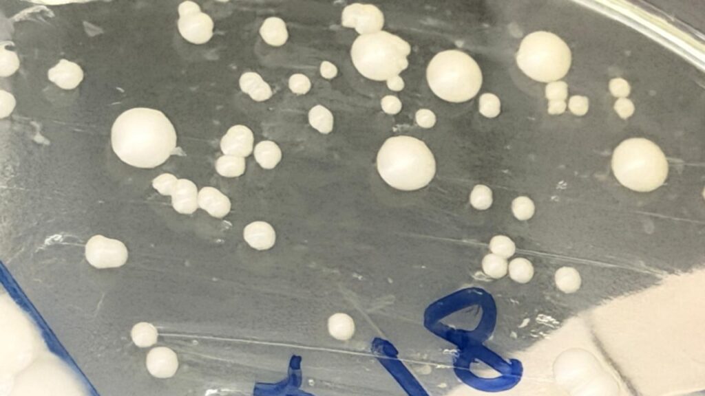 Small and large colonies of yeasts on Sabouraud dextrose agar (SDA)