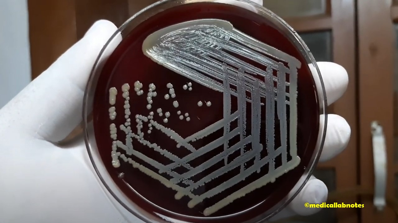 Staphylococcus aureus colony characteristics on Blood Agar-Golden yellow colony