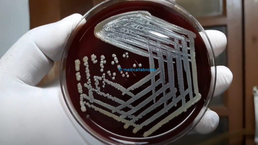A golden yellow pigment producing strain of Staphylococcus aureus on blood agar