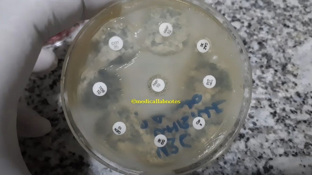Acinetobacter Antibiogram Pattern