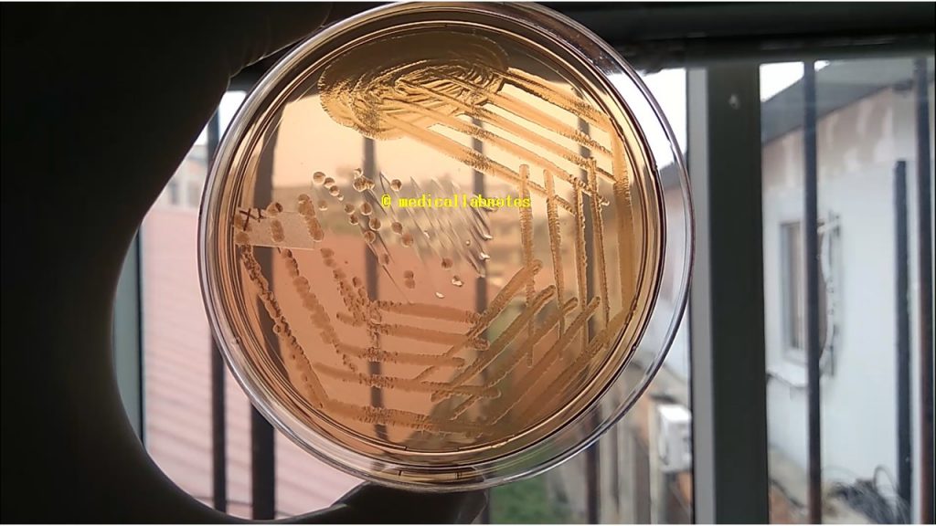 Aeromonas hydrophila colony morphology on MacConkey agar
