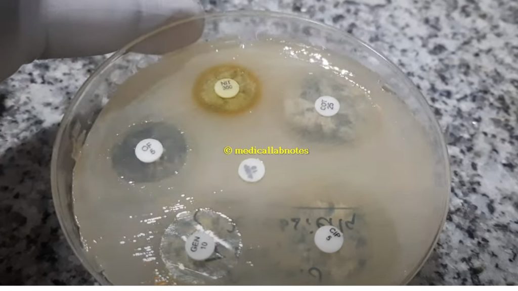 Antibiogram of Klebsiella pneumoniae isolated from urine specimen-