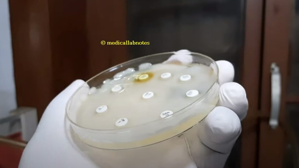 Antimicrobial Susceptibility Testing (AST) Pattern of Klebsiella pneumoniae showing MDR