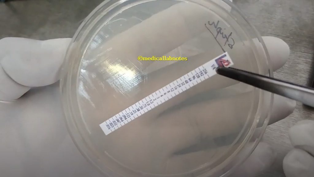 Apply E-Test strip on Muller-Hinton agar (MHA) to determine the MIC
