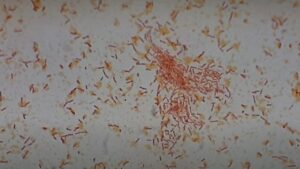 Gram Positive Bacilli or Rods: Introduction, List of Bacteria, Keyno