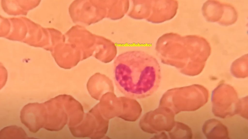 Band cell or Stab cell on Wright Stained  PBS Demonstration