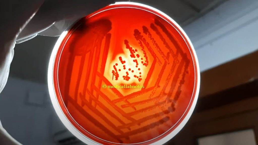 Beta-hemolytic colony of Staphylococcus aureus on blood agar demonstration
