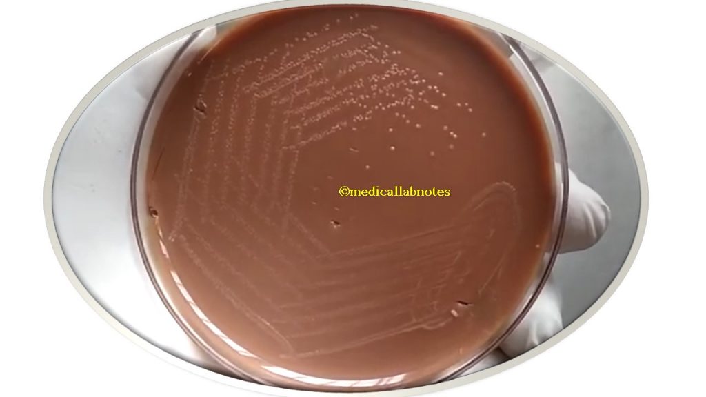 Campylobacter colony morphology on chocolate agar
