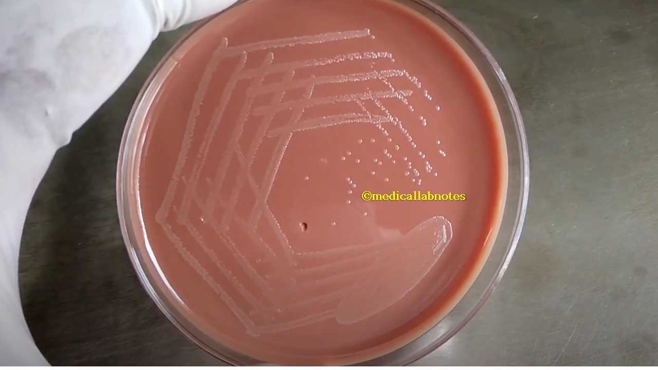 Chocolate Agar: Introduction,Composition, Principle, Preparation Requirements,Testing Procedure, Colony Characteristics, Uses, Keynotes and Chocolate Agar Footages