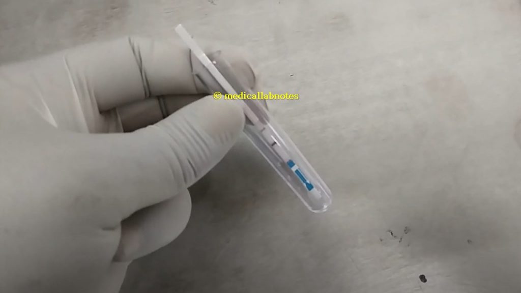 Cholera Dipstick Test Positive