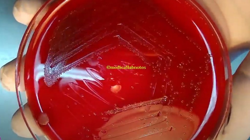 Draughtsman colony of Streptococcus pneumoniae on blood agar demonstration