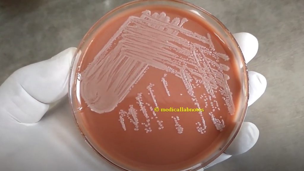 E. coli Colony Characteristics on Chocolate Agar
