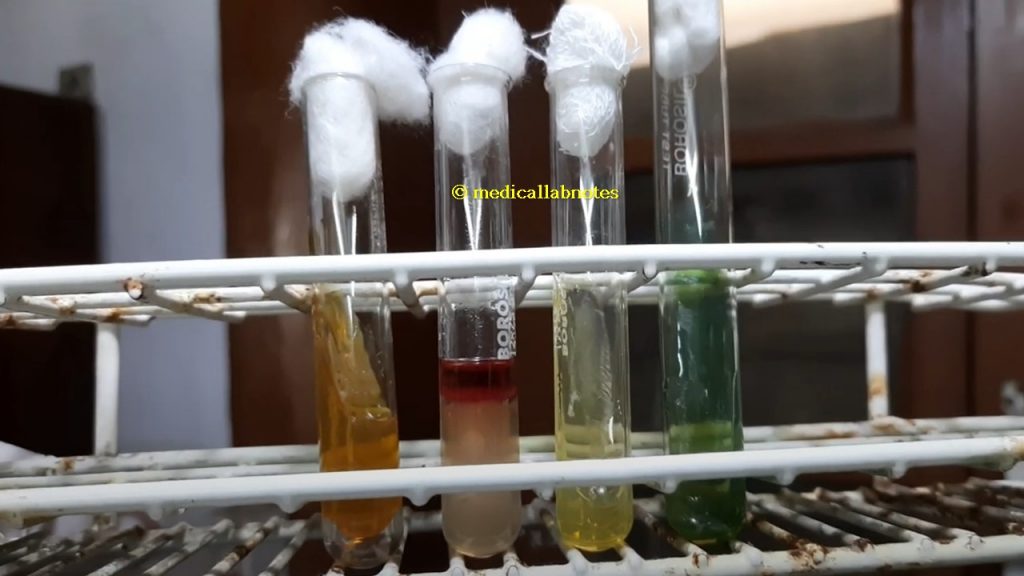 E. coli biochemical tests in TSI, SIM, Citrate and Urea agar Demonstration