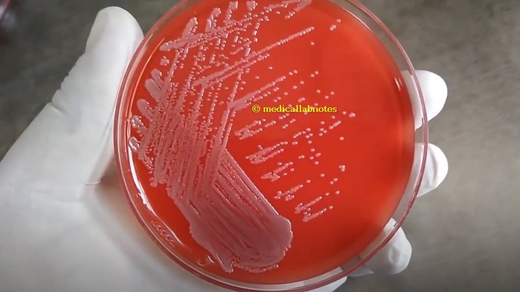 E. coli colony morphology on blood agar