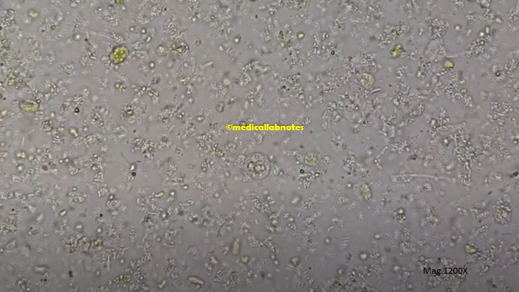 Entamoeba histolytica Cyst in saline wet mount  Stool Microscopy at 1200X