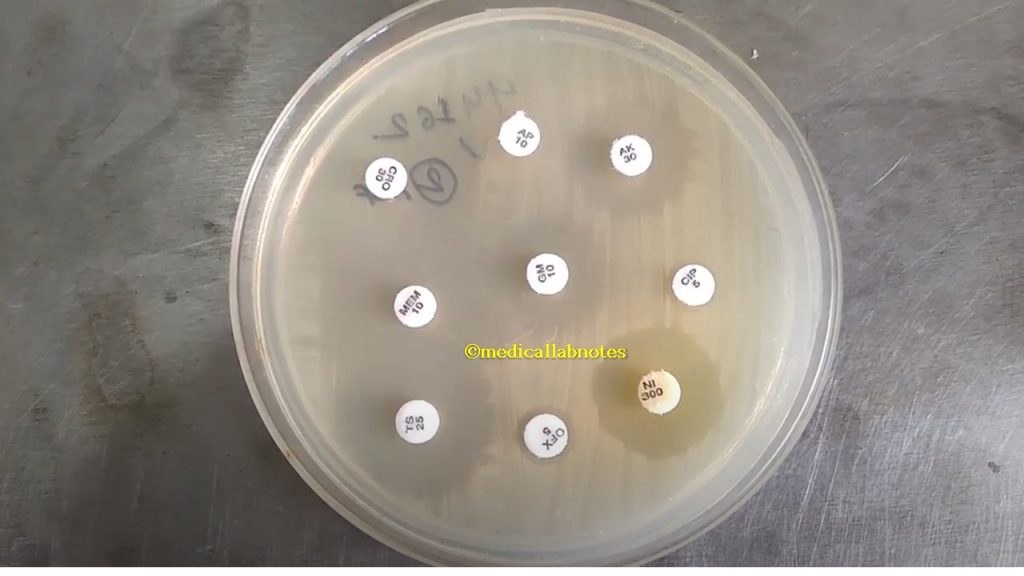 Enterobacteriaceae (Escherichia coli) AST pattern-