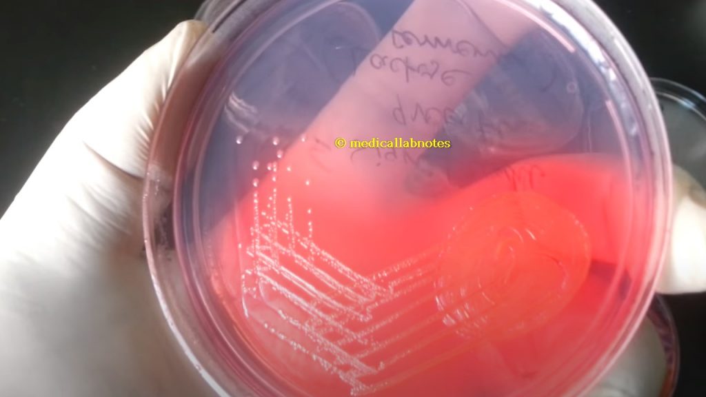 Escherichia coli on CLED agar 