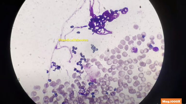 Wright Stain: Introduction, Principle, Preparation, Procedure, Result