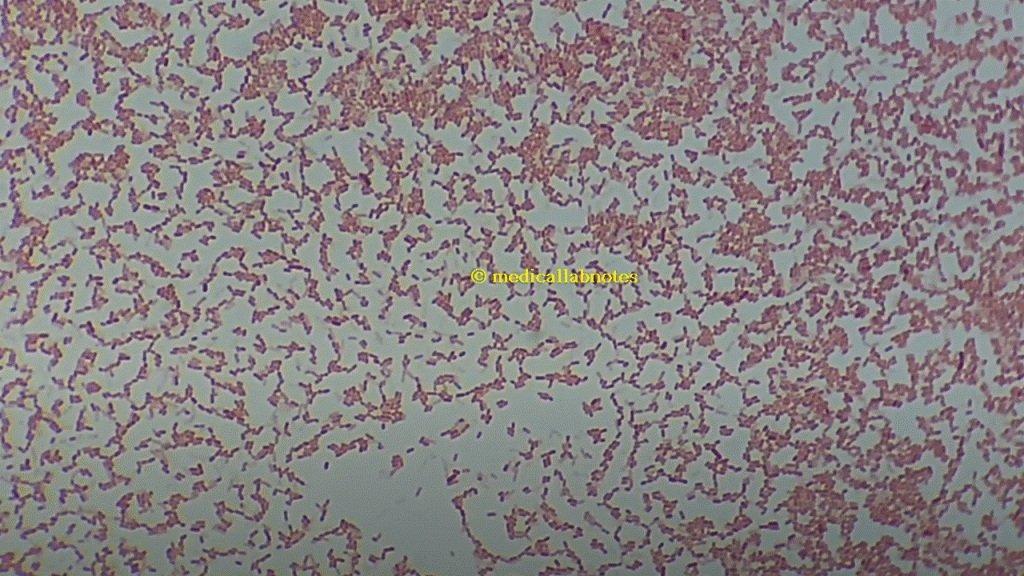 Gram negative rods (GNRs) of Serratia marcescens in Gram staining of culture
