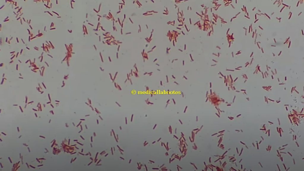 Gram negative rods of Klebsiella pneumoniae in Gram staining of culture