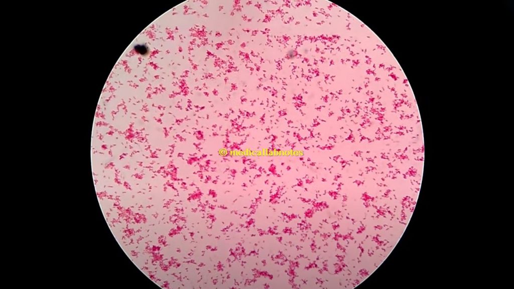Gram negative rods of Salmonella Typhi in Gram staining of culture