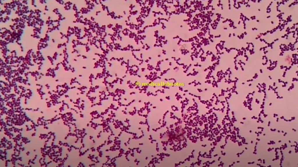 Gram positive cocci in singles, pairs and short chains of Enterococcus in Gram staining of culture