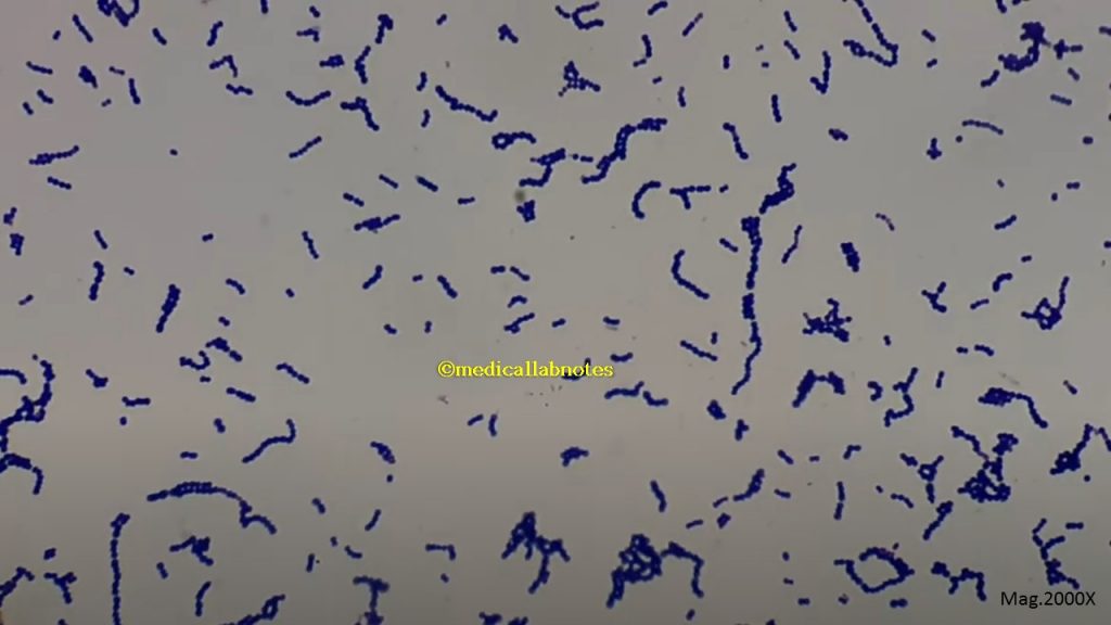 Gram positive cocci in singles, pairs, short chains and long chains of Viridans streptococci in Gram staining of culture
