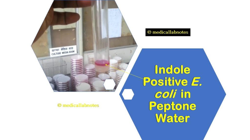 Indole positive E. coli in peptone water
