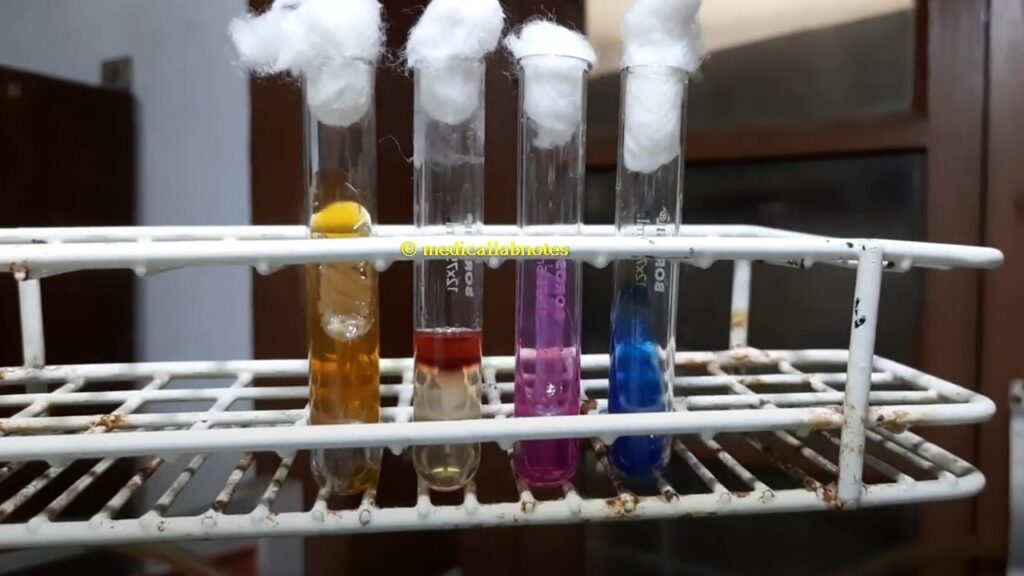 Klebsiella oxytoca biochemical tests in TSI, SIM, Citrate and Urea agar Demonstration