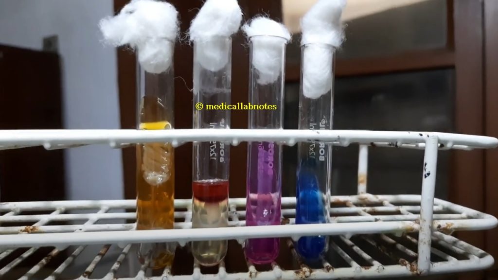 Klebsiella oxytoca biochemical tests in TSI, SIM, Urea and Citrate Agar Demonstration