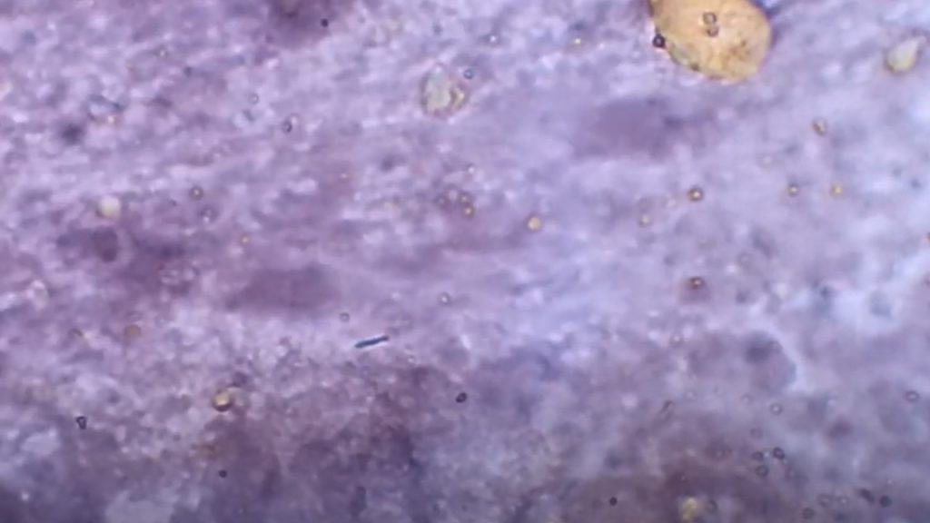 Klebsiella pneumoniae capsule in negative staining 