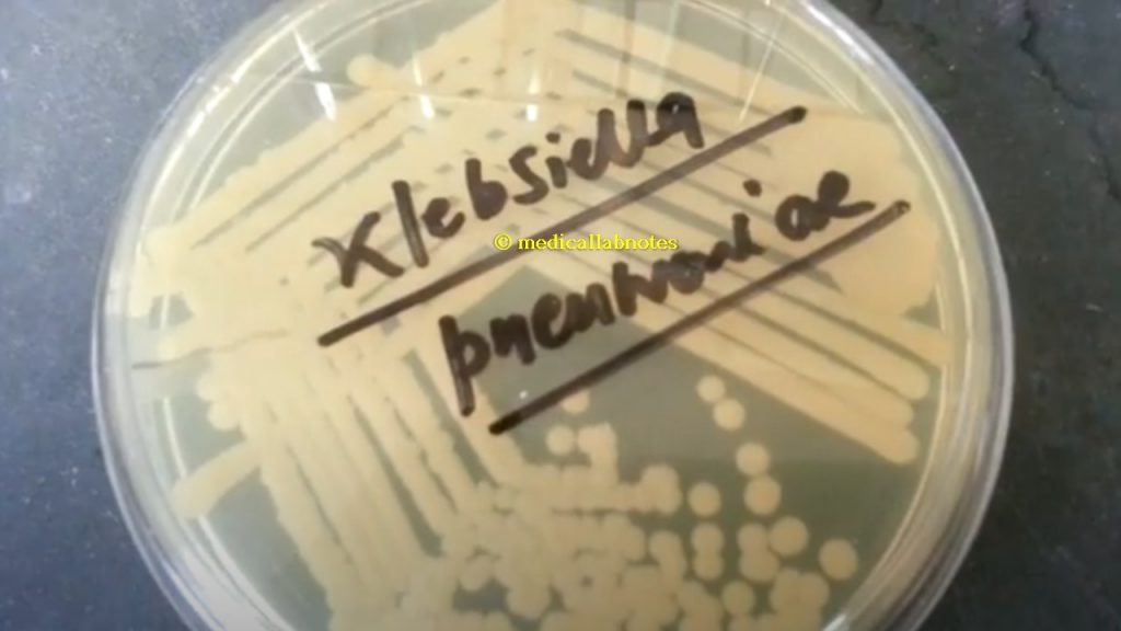 Klebsiella pneumoniae colony characteristics on nutrient agar