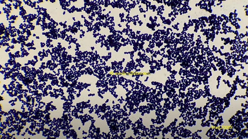 Micrococcus in Gram staining of culture showing Gram positive cocci in singles, pairs, tetrads and groups