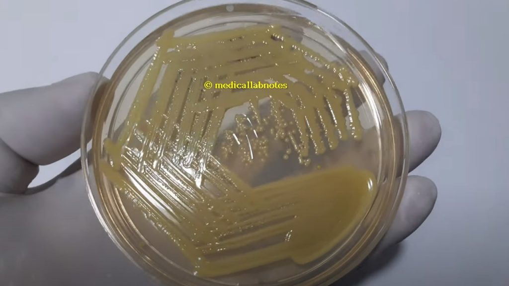 Micrococcus luteus Colony Morphology on Muller-Hinton Agar