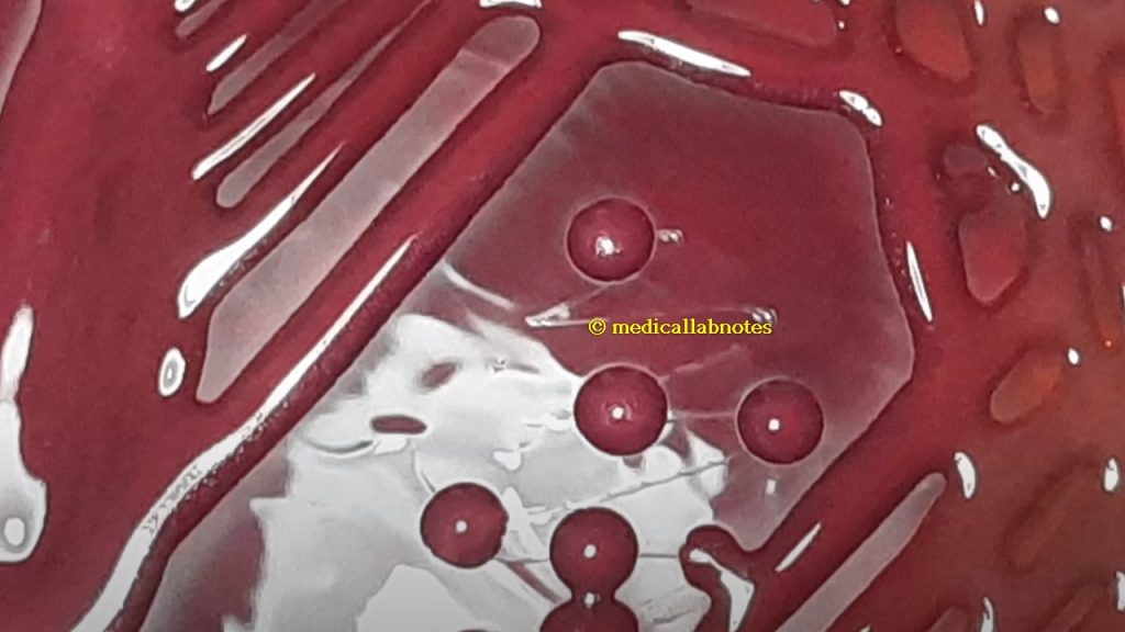 Mucoid lactose fermenting colony of Klebsiella pneumoniae on MacConkey agar